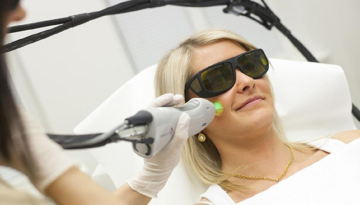 Rajeunissement au laser