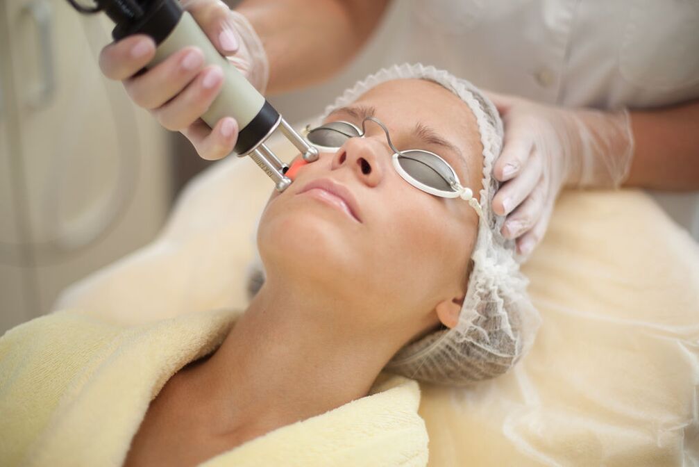 Rajeunissement au laser de la peau