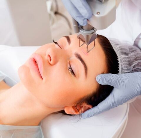 Rajeunissement au laser du visage