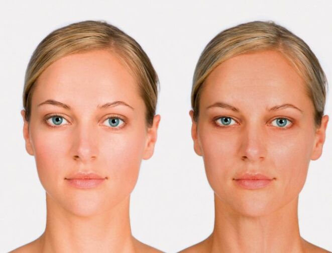 face après et avant le rajeunissement