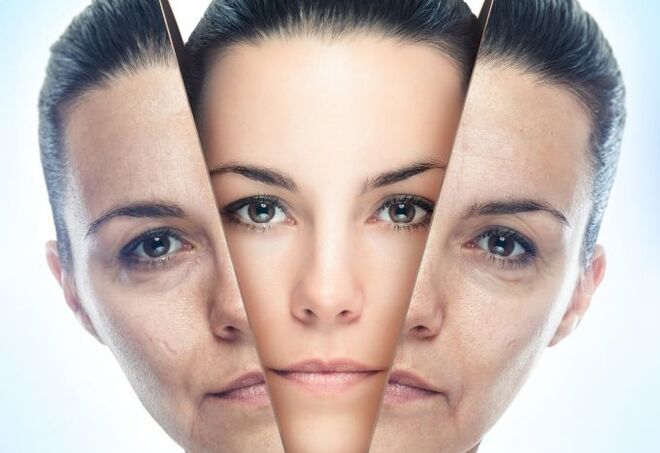 Le processus d'élimination de la peau du visage des changements liés à l'âge